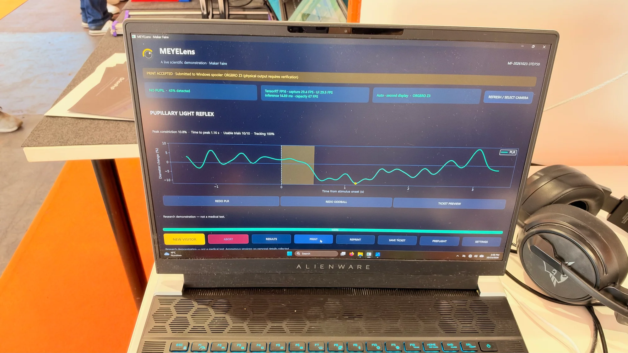 MEYE software displaying a pupillary light-reflex graph on a laptop