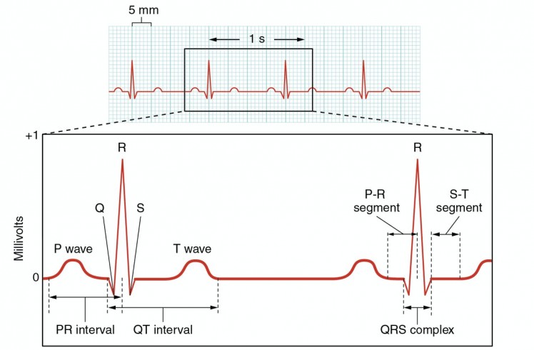 Figure 23: Heart Signal and its waves.