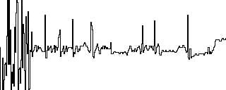 Figure 27: ECG signal received by the robot.