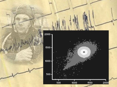 Graphic Representaton Of Heart Rate Variability